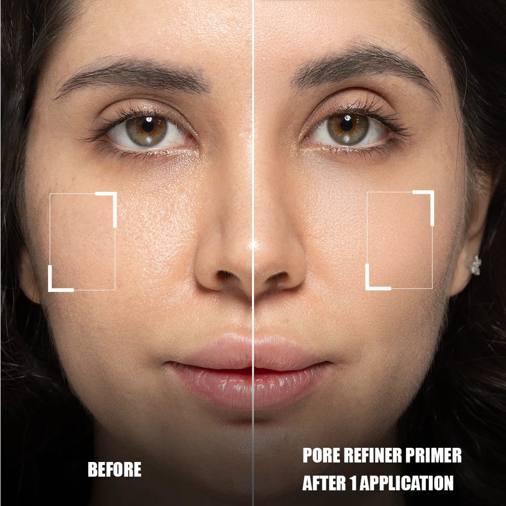 Layered Pore Refine — LYD001